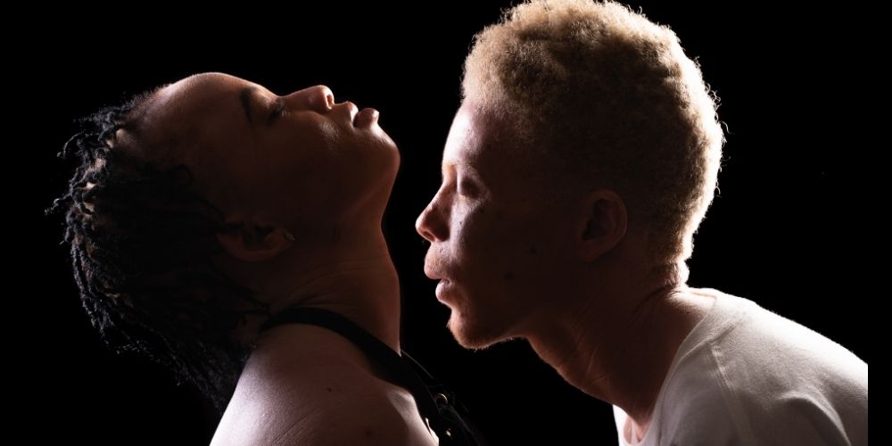 Le slameur Djamile Mama Gao réaffirme son engagement pour les albinos